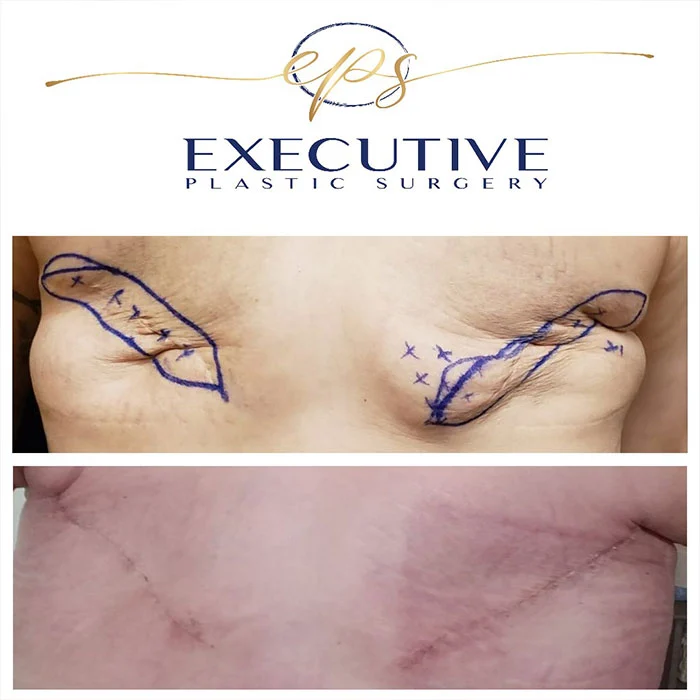 Executive Plastic Surgery logo